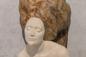 ipertrofia - Valentina