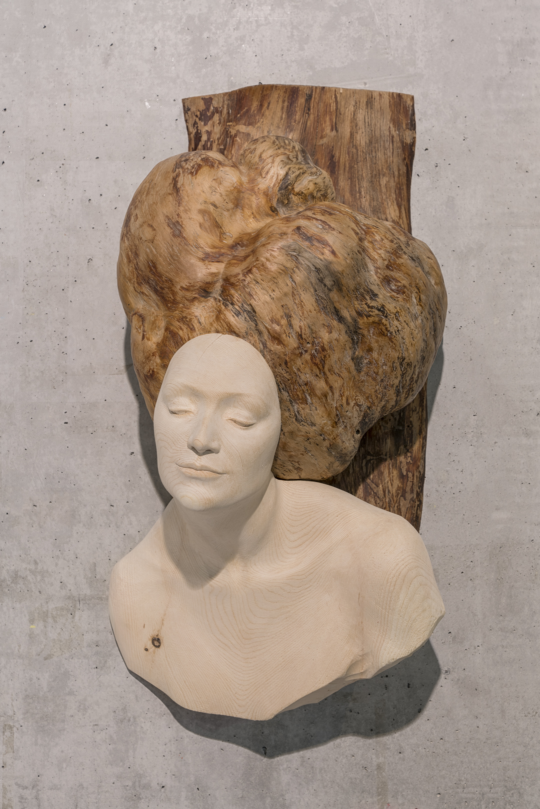 ipertrofia - Valentina