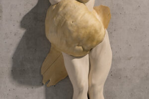 ipertrofia - maternità