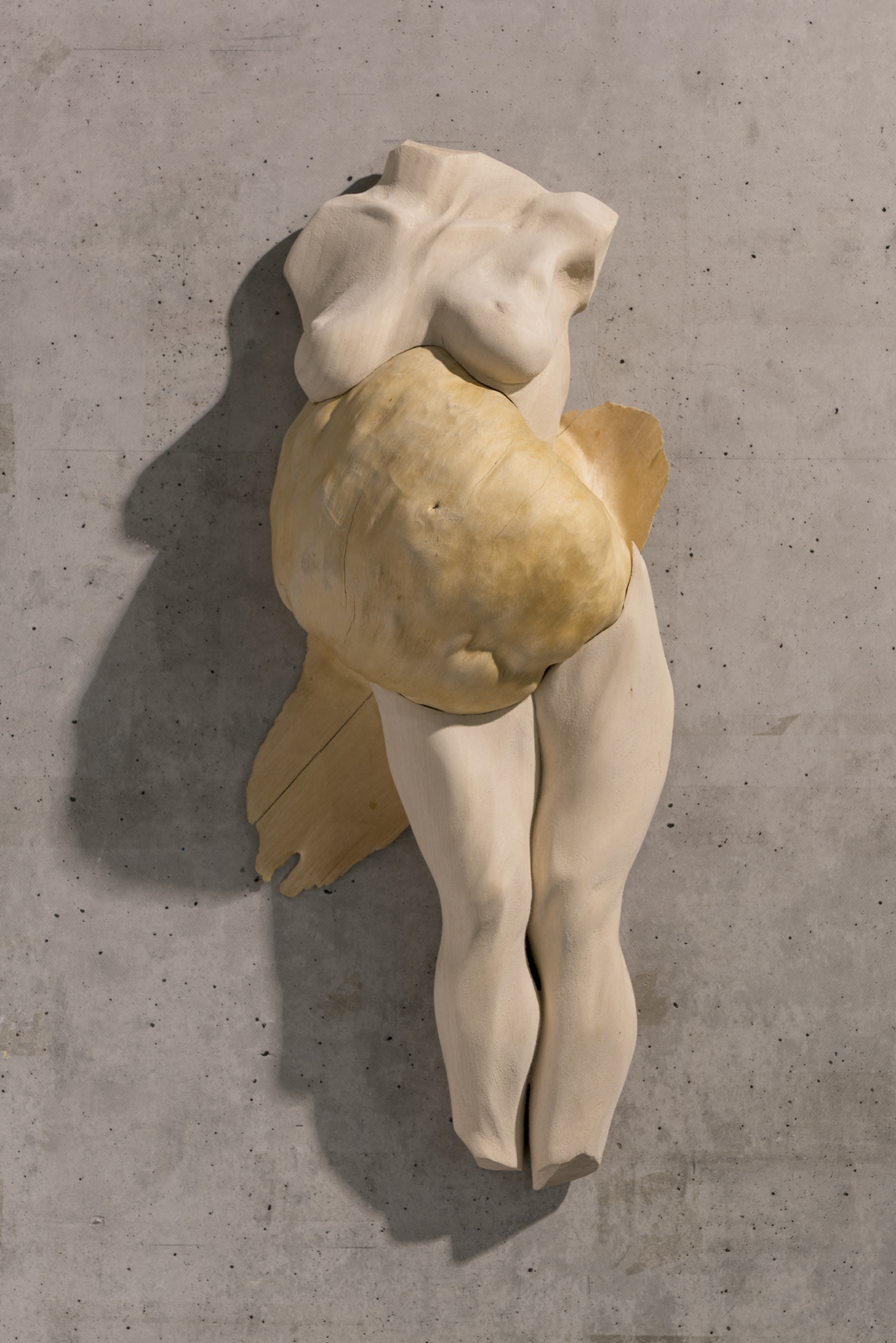 ipertrofia - maternità